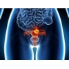 Лечение рака эндометрия (рака тела матки)  в Харбине